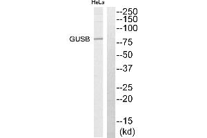 Western blot analysis of extracts from HeLa cells, using GUSB antibody. (Glucuronidase beta antibody)