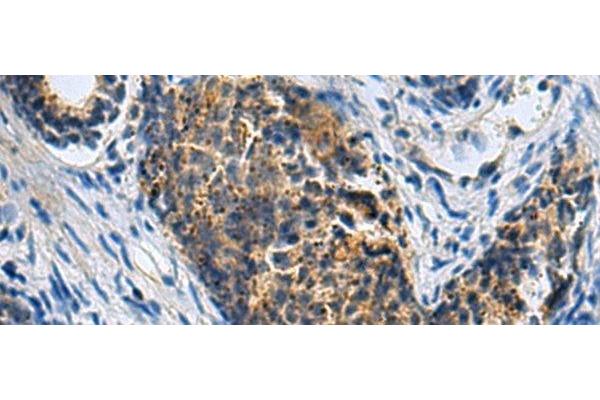 PLIN4 antibody