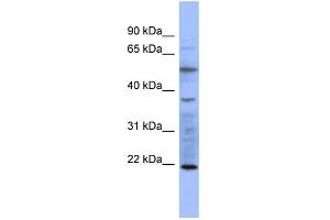 WB Suggested Anti-MYL3 Antibody Titration:  0. (MYL3/CMLC1 antibody  (N-Term))