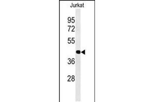Western blot analysis of ATF1 Antibody in Jurkat cell line lysates (35ug/lane) (AFT1 antibody  (C-Term))
