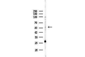 anti-Serotonin Receptor 3E (HTR3E) (Internal Region) antibody