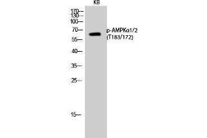 Western Blotting (WB) image for anti-AMPK1/AMPK2 (pThr172), (pThr183) antibody (ABIN3182463) (PRKAA1/PRKAA2 antibody  (pThr172, pThr183))