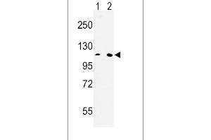 Western blot analysis of MTTP Antibody (C-term) (ABIN653011 and ABIN2842637) in Hela(lane 1), 293(lane 2) cell line lysates (35 μg/lane).