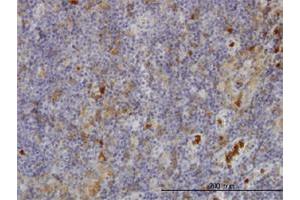 Immunoperoxidase of monoclonal antibody to FGR on formalin-fixed paraffin-embedded human lymph node. (Fgr antibody  (AA 1-90))