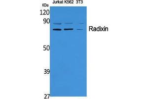 Western Blot (WB) analysis of specific cells using Radixin Polyclonal Antibody. (Radixin antibody  (Internal Region))