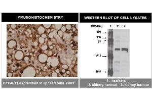 Immunohistochemistry (IHC) image for anti-Cytochrome P450, Family 4, Subfamily F, Polypeptide 11 (CYP4F11) (C-Term) antibody (ABIN264503) (CYP4F11 antibody  (C-Term))