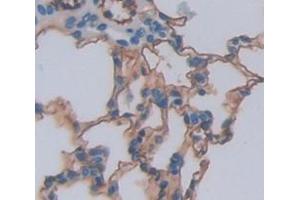 Figure. (SPRY3 antibody  (AA 88-281))