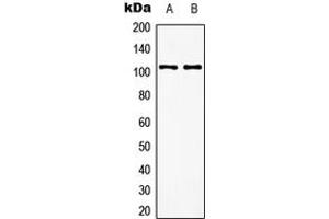 Western blot analysis of mGLUR8 expression in EOC20 (A), rat brain (B) whole cell lysates. (GRM8 antibody  (C-Term))