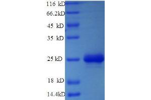 CMA1 Protein (AA 22-249, full length) (His tag)