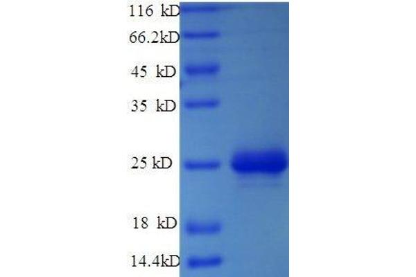 CMA1 Protein (AA 22-249, full length) (His tag)