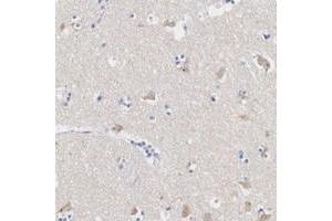 Immunohistochemical staining of human lateral ventricle with ASPHD2 polyclonal antibody  shows cytoplasmic positivity in neuronal cells.