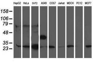 Image no. 2 for anti-phosphoglycerate Mutase 2 (Muscle) (PGAM2) antibody (ABIN1500170) (PGAM2 antibody)