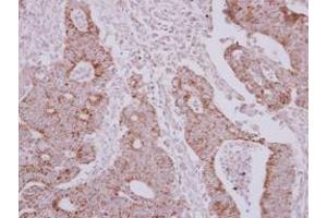 Image no. 1 for anti-Asparaginyl-tRNA Synthetase 2, Mitochondrial (Putative) (NARS2) (AA 7-276) antibody (ABIN1499648) (NARS2 antibody  (AA 7-276))
