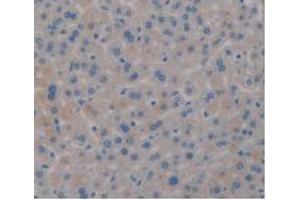 IHC-P analysis of Mouse Liver Tissue, with DAB staining. (PD-L1 antibody  (AA 48-290))