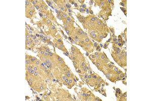 Immunohistochemistry of paraffin-embedded human stomach using PPP2CA antibody (ABIN5974047) at dilution of 1/100 (40x lens). (PPP2CA antibody)