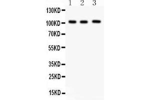 Western Blotting (WB) image for anti-Itchy E3 Ubiquitin Protein Ligase Homolog (ITCH) (AA 410-437), (Middle Region) antibody (ABIN3043253)