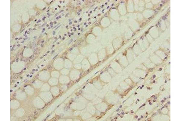 NSUN7 antibody  (AA 1-300)