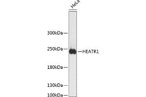 Western blot analysis of extracts of HeLa cells, using HE antibody  at 1:3000 dilution. (HEATR1 antibody  (AA 1-120))