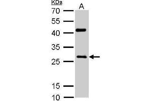 WB Image NQO1 antibody [C2C3], C-term detects NQO1 protein by Western blot analysis.