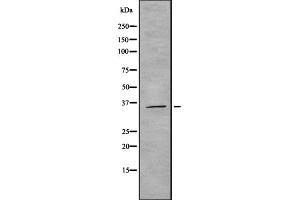 Western blot analysis of ROAA expression in HEK293 cells ,The lane on the left is treated with the antigen-specific peptide. (HNRNPAB antibody  (N-Term))