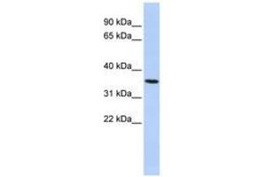 Image no. 1 for anti-Progestin and AdipoQ Receptor Family Member VI (PAQR6) (AA 72-121) antibody (ABIN6741069) (PAQR6 antibody  (AA 72-121))