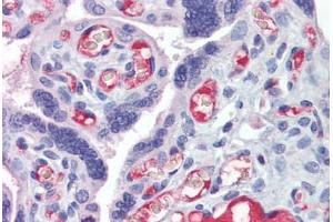 Placenta, Human: Formalin-Fixed, Paraffin-Embedded (FFPE) (HMOX1 antibody)
