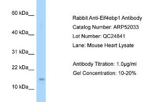 Western Blotting (WB) image for anti-Eukaryotic Translation Initiation Factor 4E Binding Protein 1 (EIF4EBP1) (N-Term) antibody (ABIN970615) (eIF4EBP1 antibody  (N-Term))