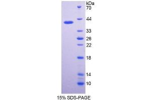 SDS-PAGE analysis of Rabbit Interferon alpha Protein.