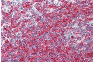 Human Spleen (formalin-fixed, paraffin-embedded) stained with PDCD4 antibody ABIN364343 at 5 ug/ml followed by biotinylated anti-mouse IgG secondary antibody ABIN481714, alkaline phosphatase-streptavidin and chromogen. (PDCD4 antibody  (AA 1-469))