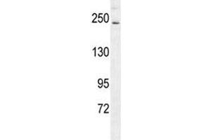 RICTOR antibody western blot analysis in mouse bladder tissue lysate. (RICTOR antibody  (AA 1617-1650))
