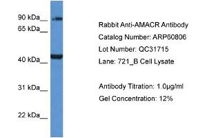 Western Blotting (WB) image for anti-alpha-Methylacyl-CoA Racemase (AMACR) (C-Term) antibody (ABIN2774297) (AMACR antibody  (C-Term))