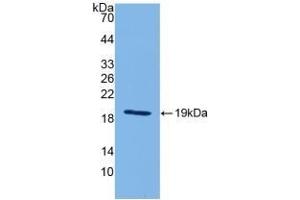 Detection of Recombinant IL18, Mouse using Polyclonal Antibody to Interleukin 18 (IL18) (IL-18 antibody  (AA 36-192))