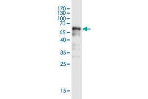 Western Blot detection against Immunogen (58. (BOD1L1 antibody  (AA 1-284))