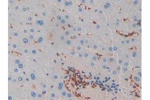 DAB staining on IHC-P; Samples: Human Liver Tissue (IL-2 antibody  (AA 21-153))