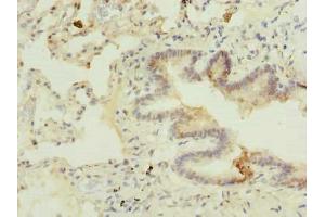 Immunohistochemistry of paraffin-embedded human lung tissue using ABIN7174888 at dilution of 1:100 (C7orf61 antibody  (AA 1-206))