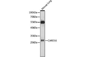 Western blot analysis of extracts of mouse lung, using C antibody (ABIN7266127) at 1:1000 dilution. (CARD16 antibody  (AA 50-150))