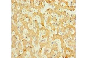 Immunohistochemistry of paraffin-embedded human liver tissue using ABIN7165010 at dilution of 1:100 (ABHD14B antibody  (AA 2-210))