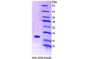 SDS-PAGE (SDS) image for Complement Factor B (CFB) (AA 474-590) protein (His tag) (ABIN1170194) (Complement Factor B Protein (CFB) (AA 474-590) (His tag))