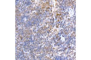 Immunohistochemistry of paraffin-embedded mouse spleen using TR Rabbit mAb (ABIN7270870) at dilution of 1:200 (40x lens). (TRAPPC2 antibody)