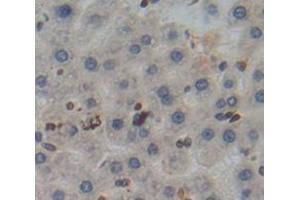 IHC-P analysis of Kidney tissue, with DAB staining. (Poliovirus Receptor antibody  (AA 22-255))