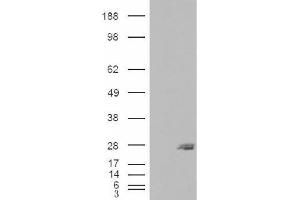 Image no. 1 for anti-SAR1 Homolog B (SAR1B) (Internal Region) antibody (ABIN375115) (SAR1B antibody  (Internal Region))