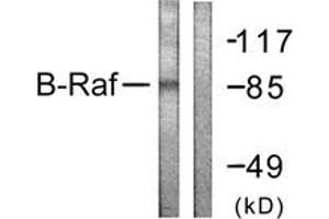 Western blot analysis of extracts from K562 cells, using B-RAF (Ab-601) Antibody.