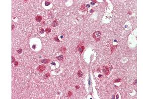 Anti-IDS antibody IHC staining of human brain, cortex. (IDS antibody  (AA 154-203))