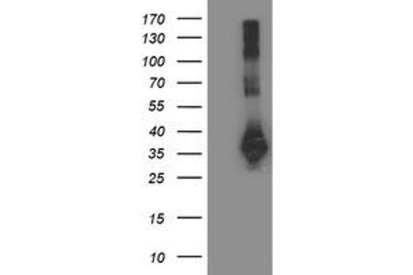 SIRT5 antibody