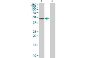 Western Blot analysis of PRKAR1A expression in transfected 293T cell line by PRKAR1A MaxPab polyclonal antibody. (PRKAR1A antibody  (AA 1-381))