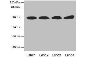 Western blot All lanes: TBCEL antibody at 12 μg/mL Lane 1: Rat gonadal tissue Lane 2: PC-3 whole cell lysate Lane 3: Rat heart tissue Lane 4: 293T whole cell lysate Secondary Goat polyclonal to rabbit IgG at 1/10000 dilution Predicted band size: 49 kDa Observed band size: 49 kDa (TBCEL antibody  (AA 1-424))