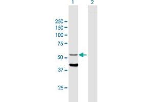 Western Blotting (WB) image for anti-Cytochrome P450, Family 4, Subfamily F, Polypeptide 12 (CYP4F12) (AA 1-524) antibody (ABIN528822)