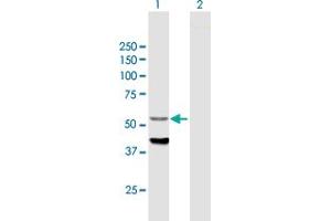 Western Blot analysis of CYP4F12 expression in transfected 293T cell line by CYP4F12 MaxPab polyclonal antibody. (CYP4F12 antibody  (AA 1-524))