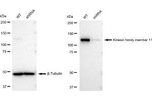 Western blotting analysis using Kinesin family member 11 antibody (ABIN7799200).
