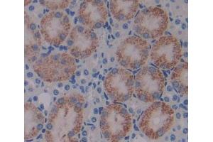 #VALUE! (HIBCH antibody  (AA 1-170))